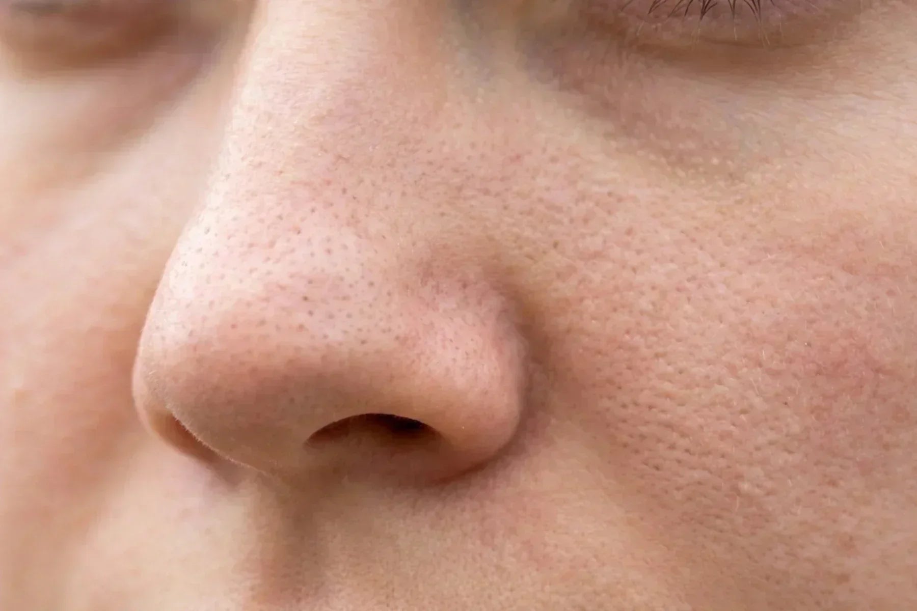 Rostro de mujer con los poros abiertos