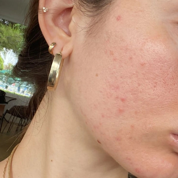 Antes Rutina Corrección Global – tono, arrugas e imperfecciones