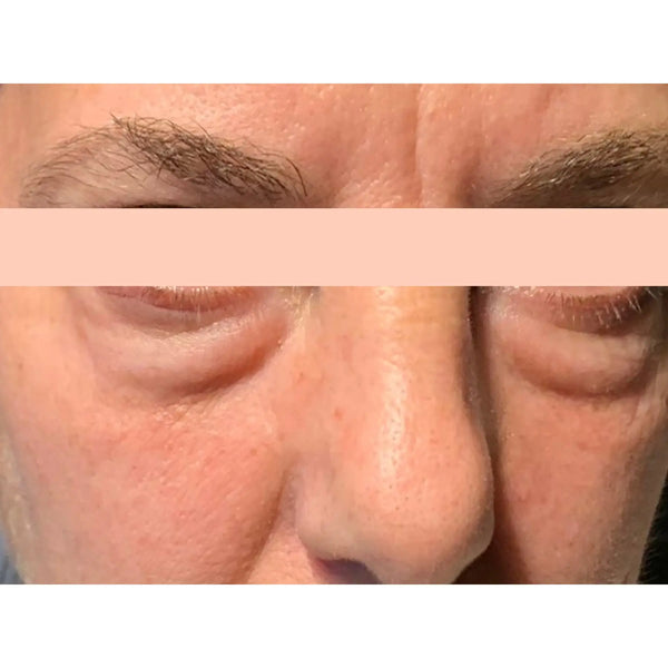 Antes Rutina Corrección Global – tono, arrugas e imperfecciones