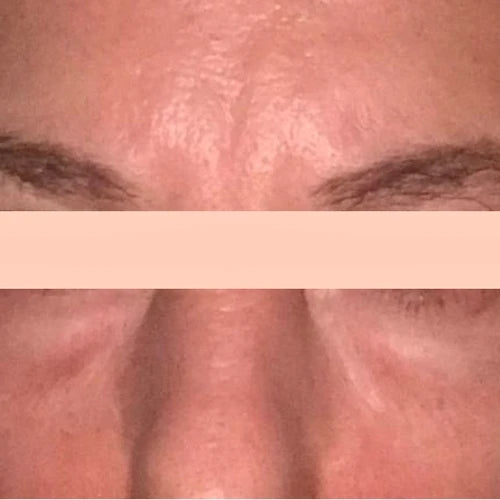 Después Rutina Corrección Global – tono, arrugas e imperfecciones