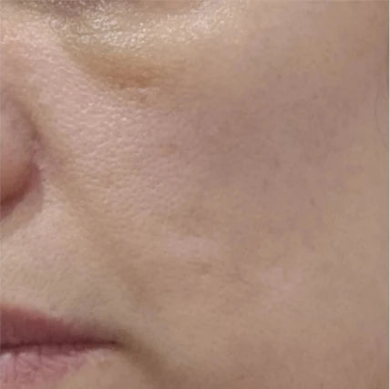 Antes Rutina Contorno de ojos Día y Noche - Ojeras, bolsas y arrugas
