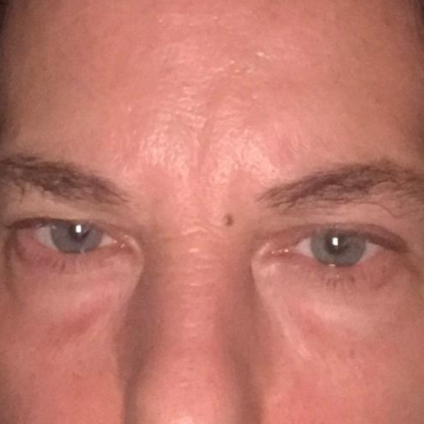 Después Rutina Contorno de ojos Día y Noche - Ojeras, bolsas y arrugas