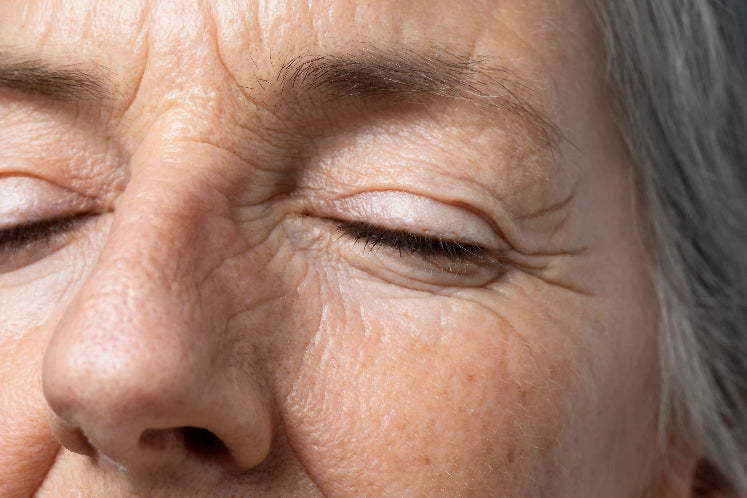 Mujer mayor, con los ojos cerrados y arrugas muy marcadas por la zona del contorno de ojos.